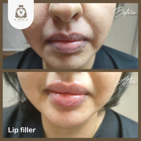 Before and after case, Dr. Nesma Adel clinic 2